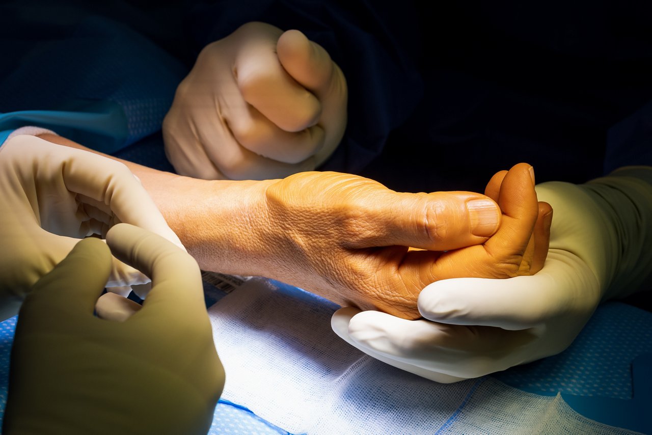 Nahaufnahme von den Händen der Ärzte und des Patienten bei einer Operation