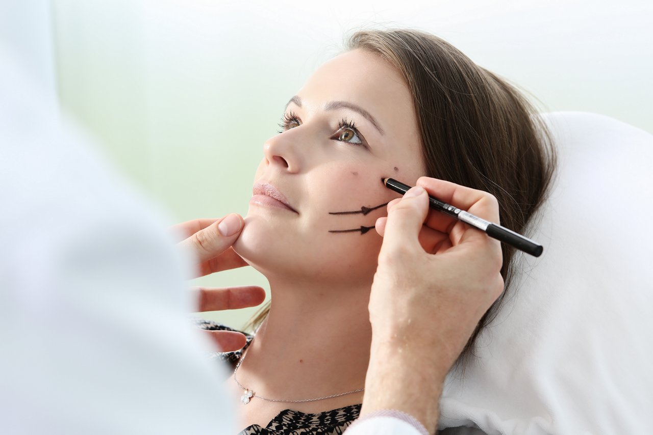 Arzt des plastisch-chirurgischen Fachbereiches zeichnet Korrekturlinien im Gesicht einer Patienten, die auf einem Behandlungsstuhl liegt.. 