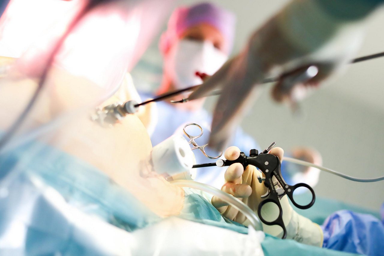 Chirurg nimmt einen minimalinvasiven Eingriff vor