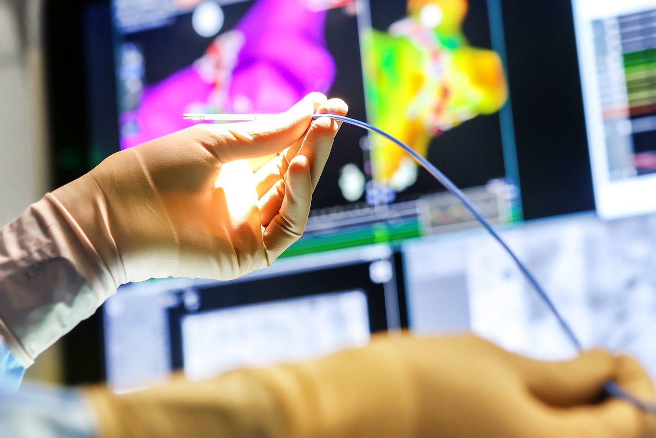 Im Herzkatheterlabor: Optimale Hilfe bei Herzrhythmusstörungen