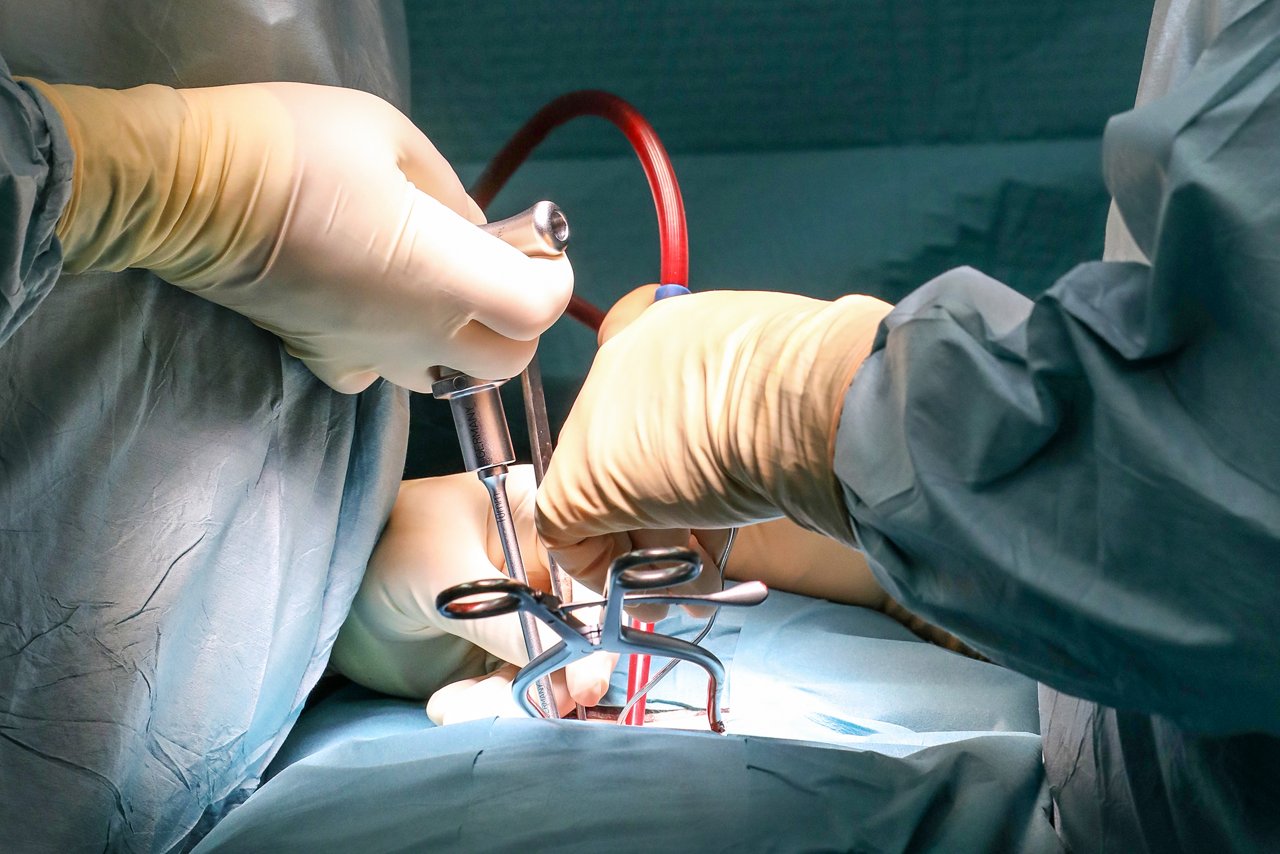 Orthopäden bei einer OP