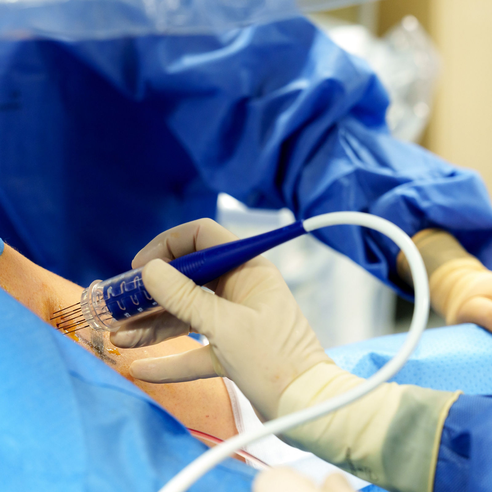 BEST-Therapie erstmalig klinisch im Einsatz