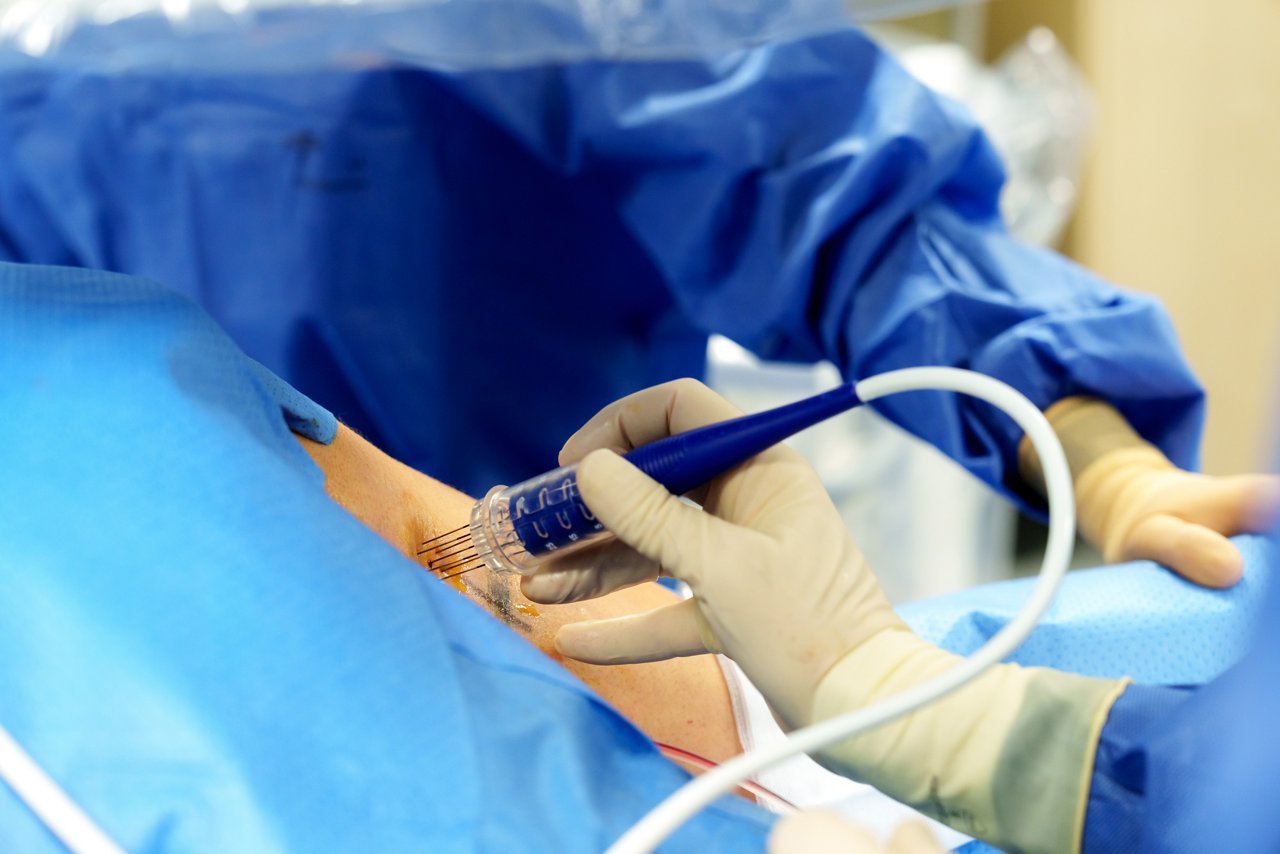 BEST-Therapie erstmalig klinisch im Einsatz