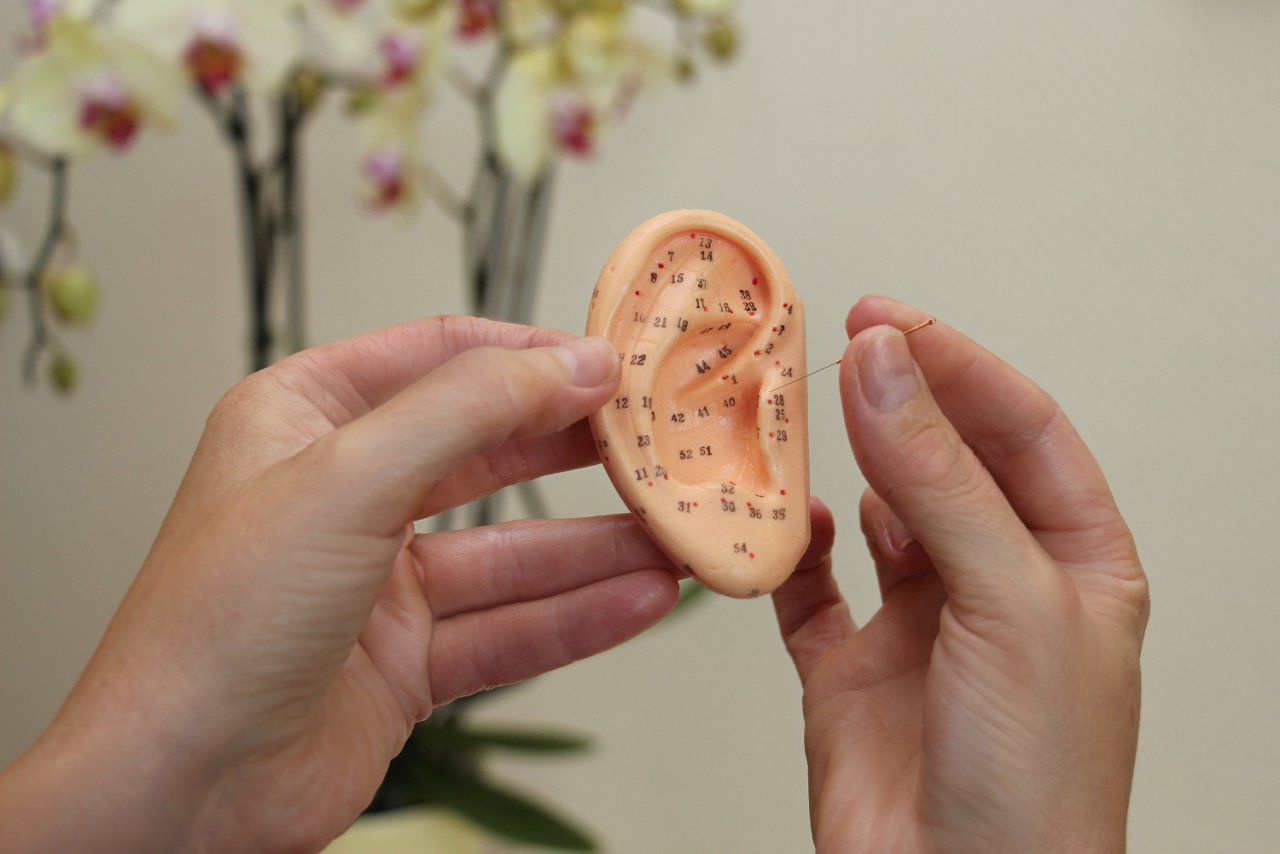 Behandlung Akupunktur am Ohr