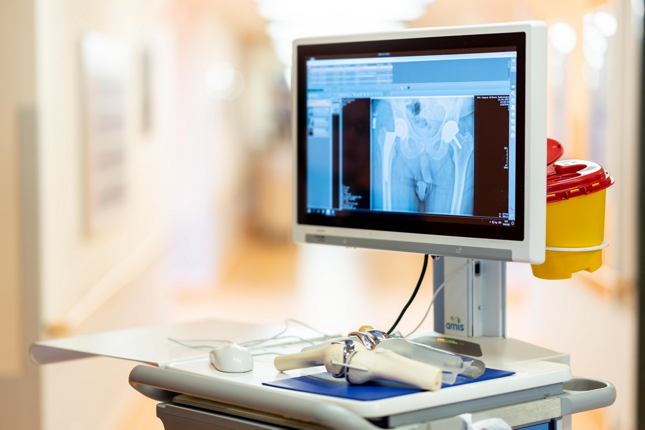Röntgenbild einer eingesetzten Hüftendoprothese auf dem Monitor