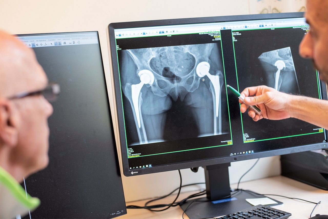 Röntgenbild auf einem PC zeigt zwei künstliche Hüftgelenke 