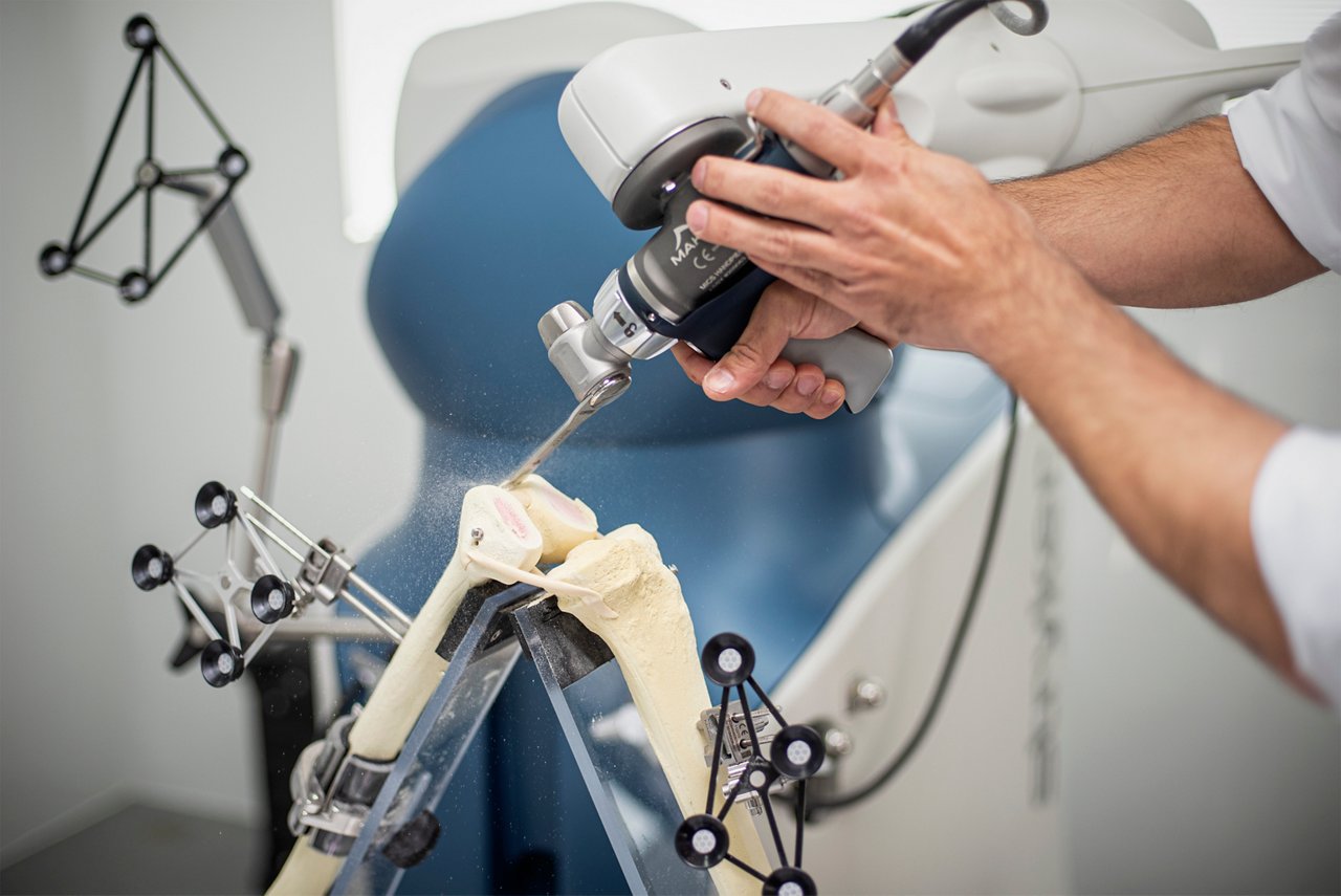 Roboterassistierte Knie-OP am Ortho-Campus in Huels mit dem MAKO-System