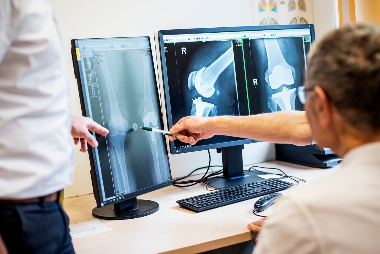 Postoperatives Röntgenbild einer Knieprothese