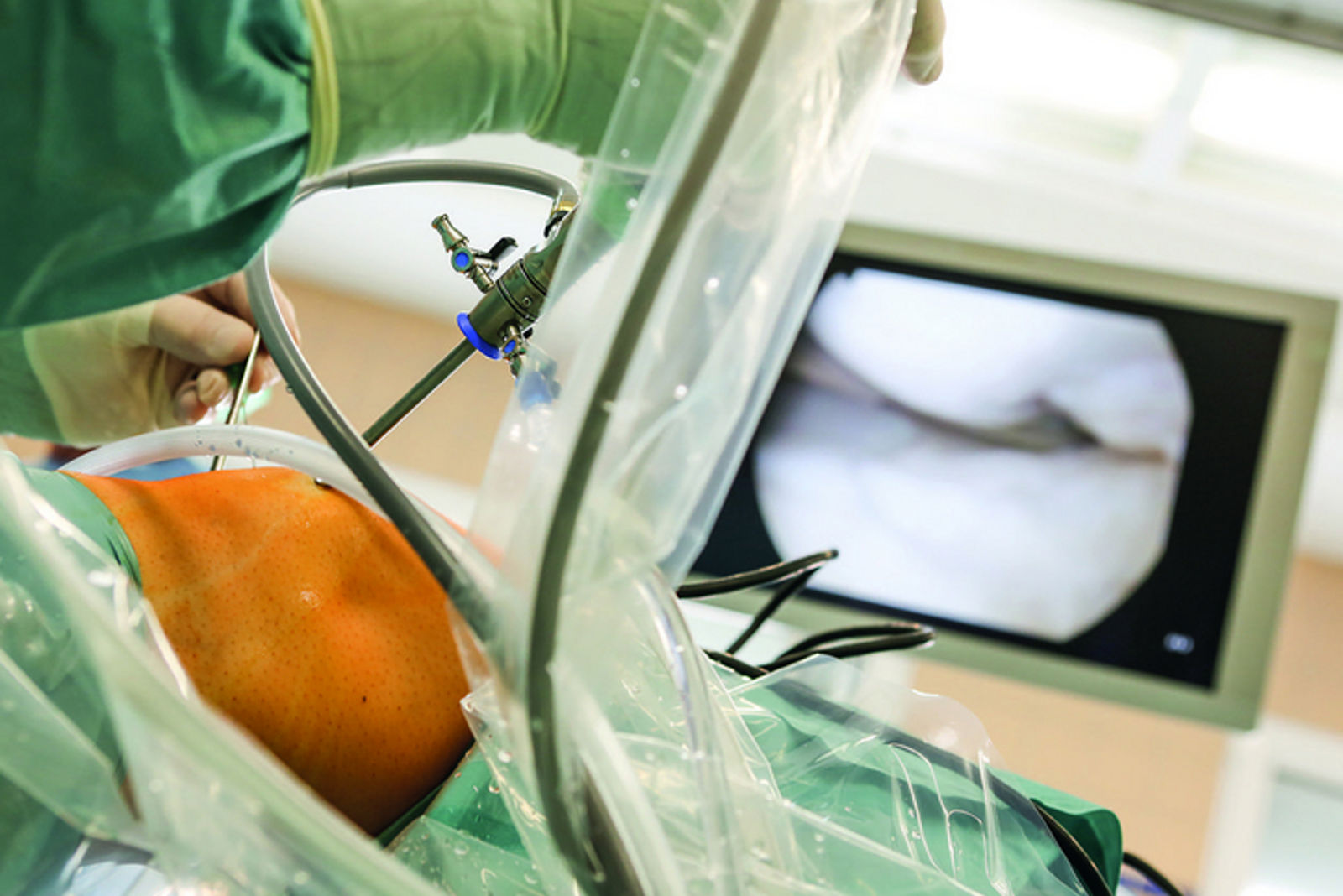Arthroskopie: Der schonende Eingriff ins Gelenk