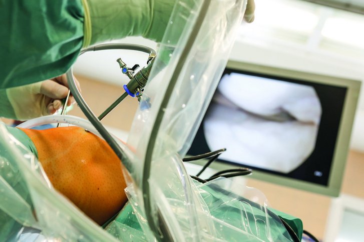 Durchführung einer Knie-Arthroskopie im Operationssaal