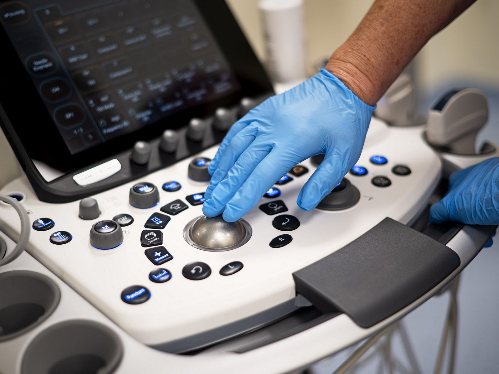 Interventionelle Endoskopie in der Gastroenterologie 