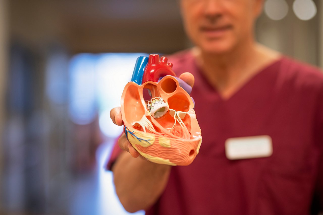 Chefarzt Prof. Bufe am Herzzentrum Niederrhein Krefeld zeigt ein Herzmodell mit Tavi 