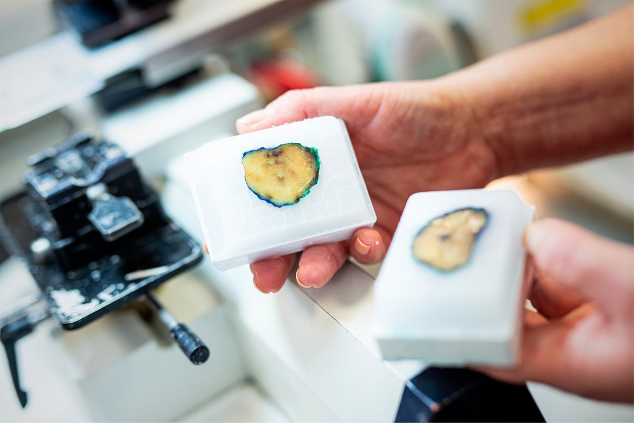 Querschnitt einer operativ entfernten Prostata in der Pathologie in Krefeld