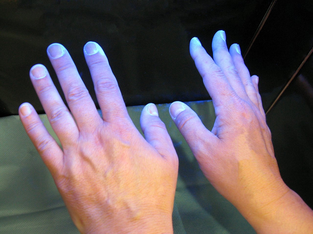Desinfizierte Hände unter Schwarzlicht