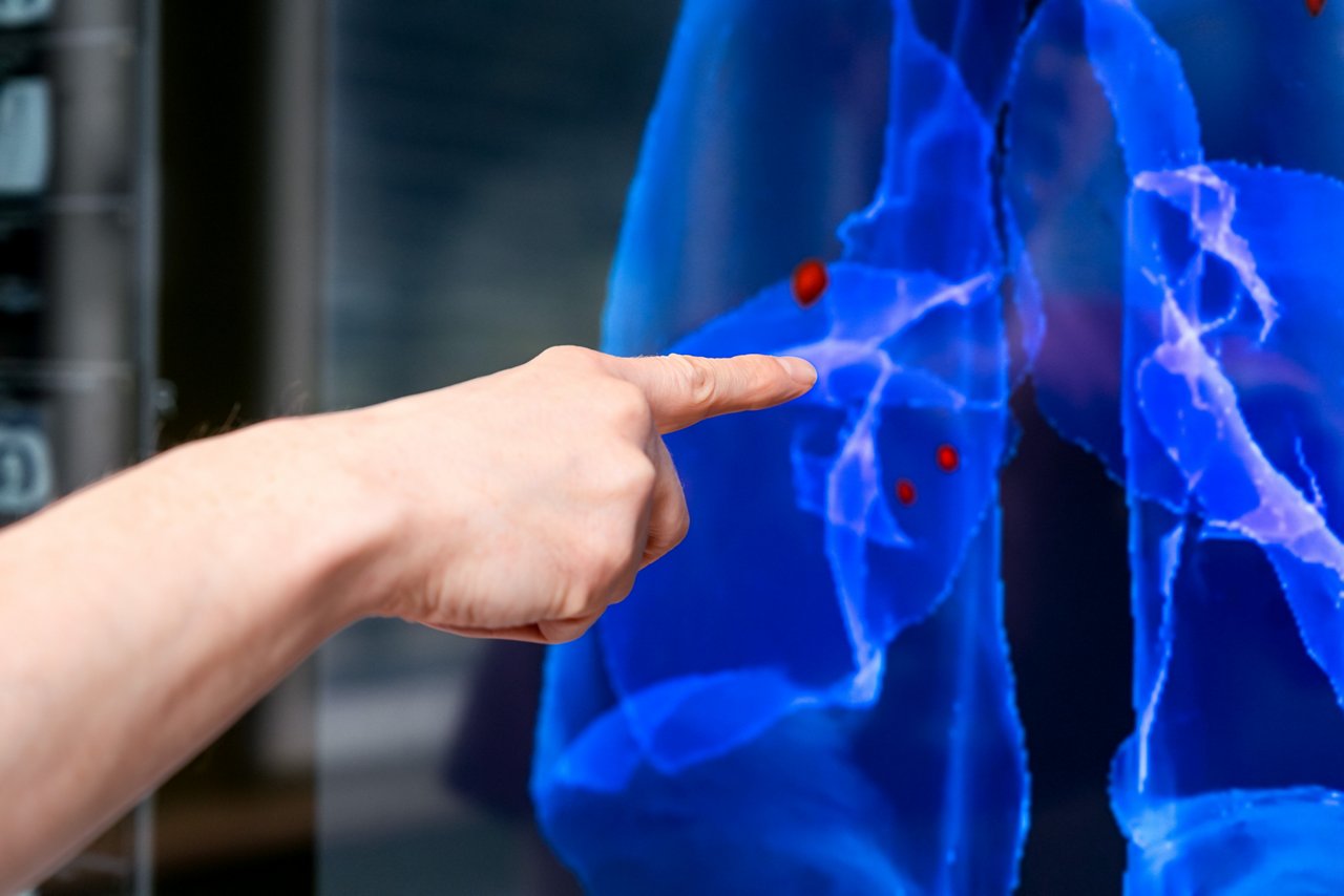 Ein Arzt zeigt auf eine digitale Darstellung der Lunge, die wichtige Informationen über Lungenerkrankungen oder -anomalien hervorhebt. Präzise Diagnosen durch moderne Technologie.