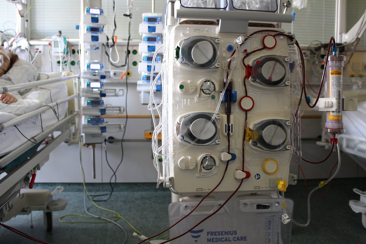 Ein Patient liegt im Bett während er am Dialysegerät angeschlossen ist.
