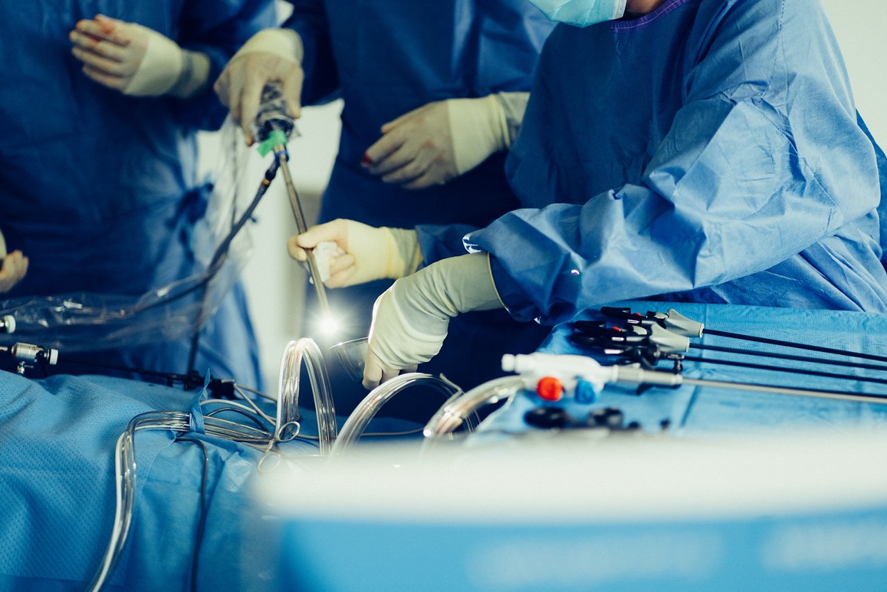 Endoskop im Operationssaal für die minimalinvasive Chirurgie