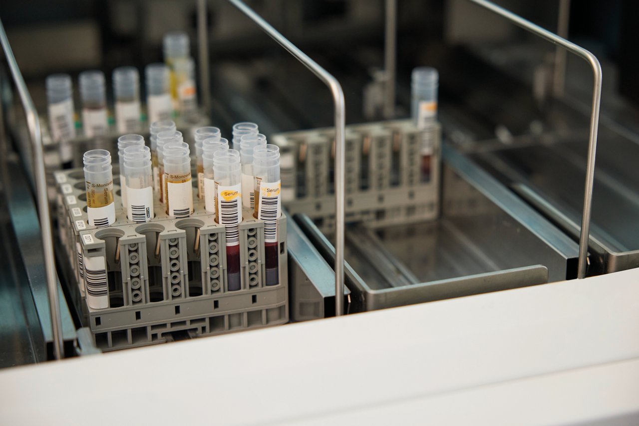 Proben im Labor im Regal