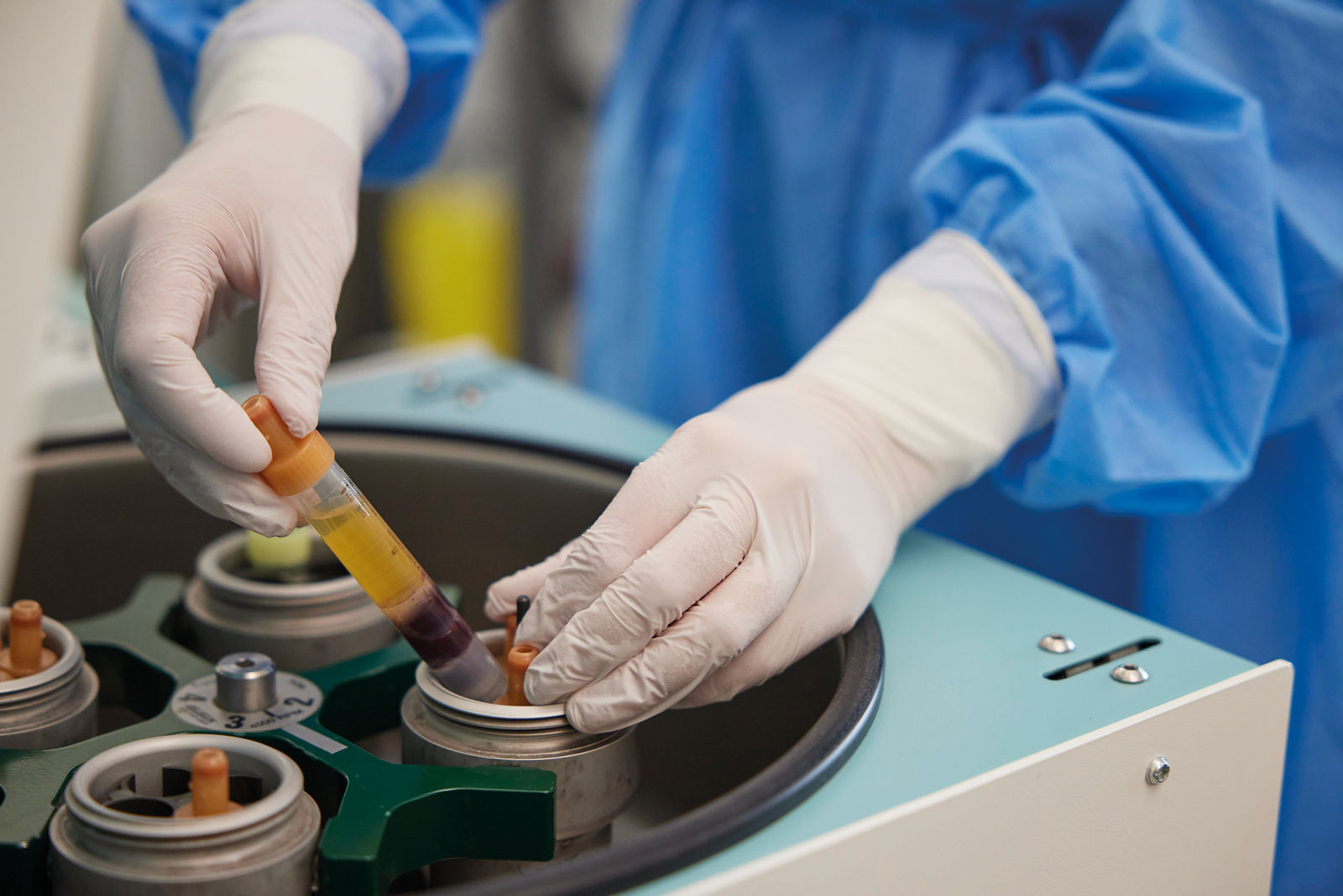 Probe wird im Labor aus Zentrifuge entnommen