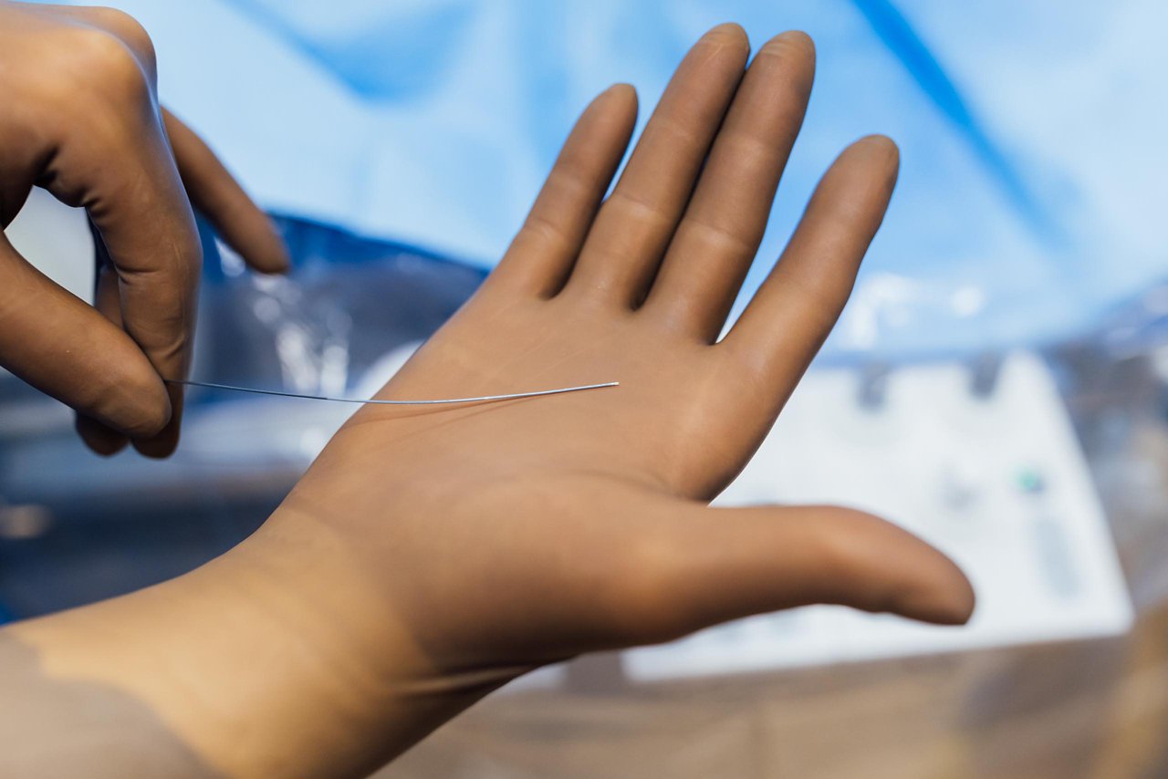 Kathetergestützer Eingriff