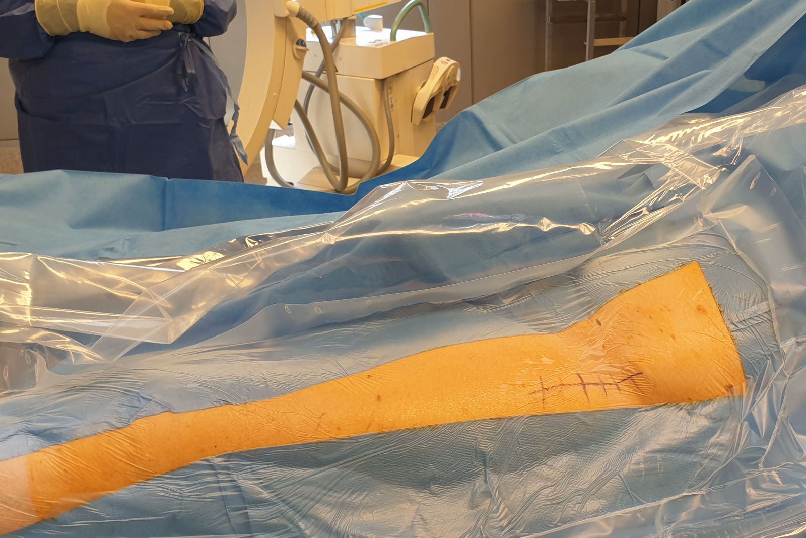 Bild Endoprothetik-OP Hüfte