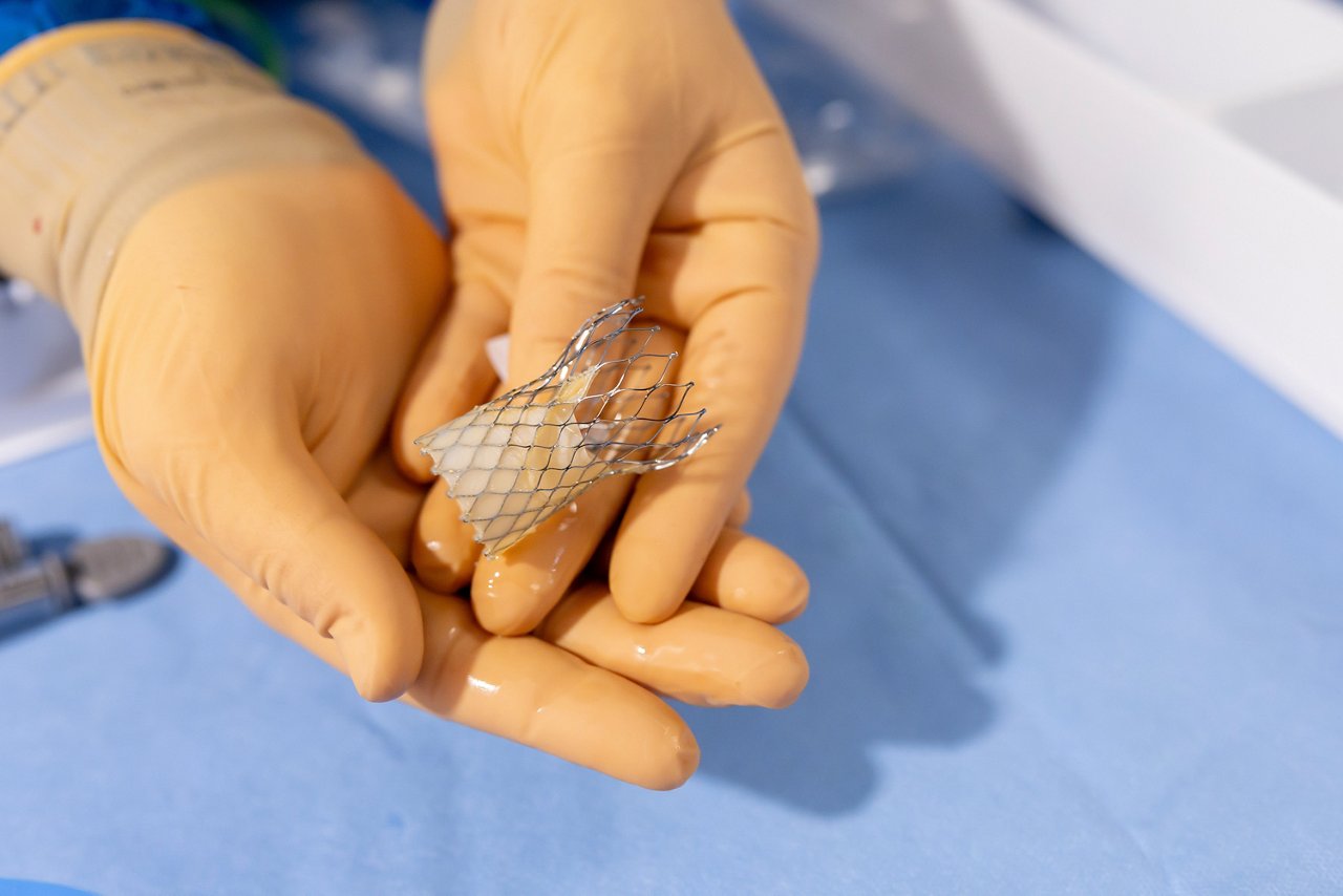 TAVI-Eingriff Helios Siegburg