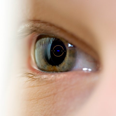 UNtersuchung des Auges - Pupille