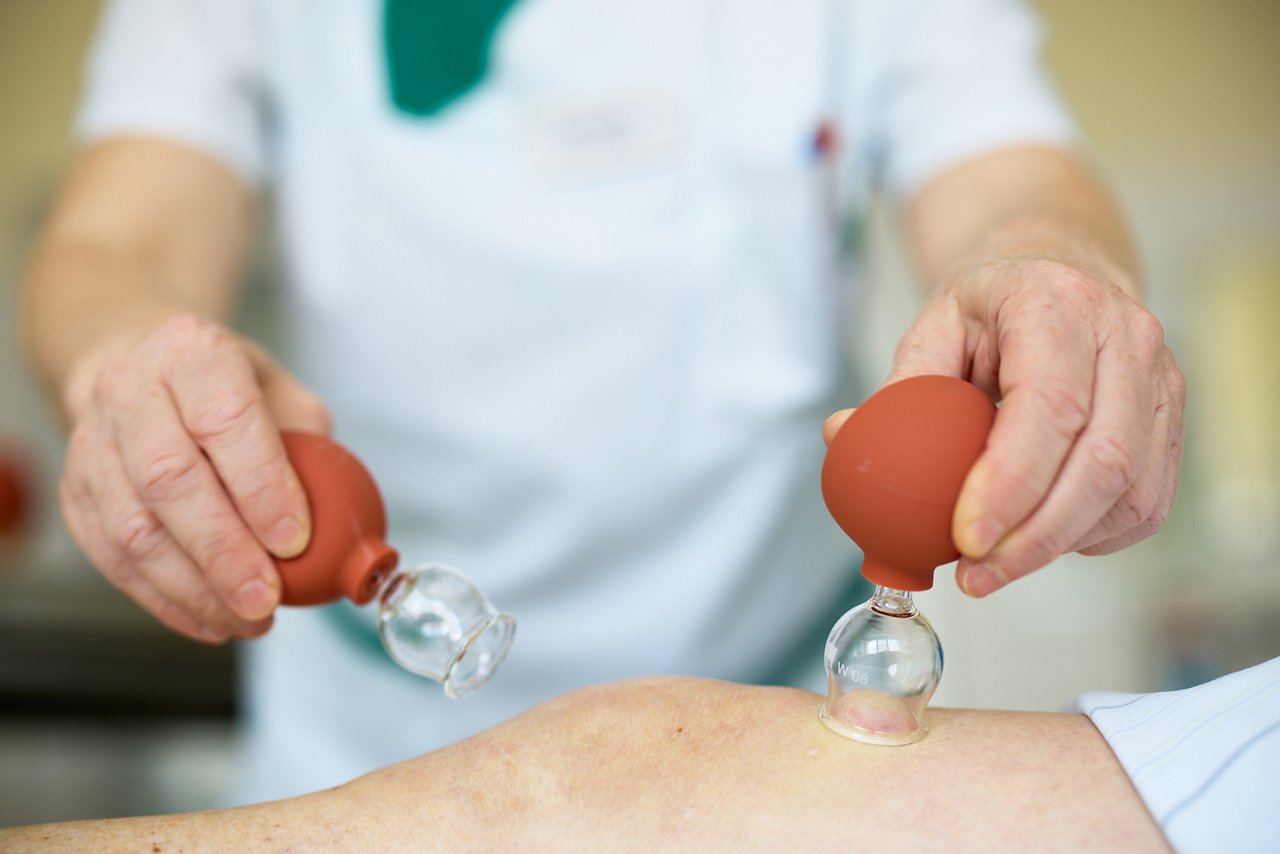 Schröpfen am Rücken