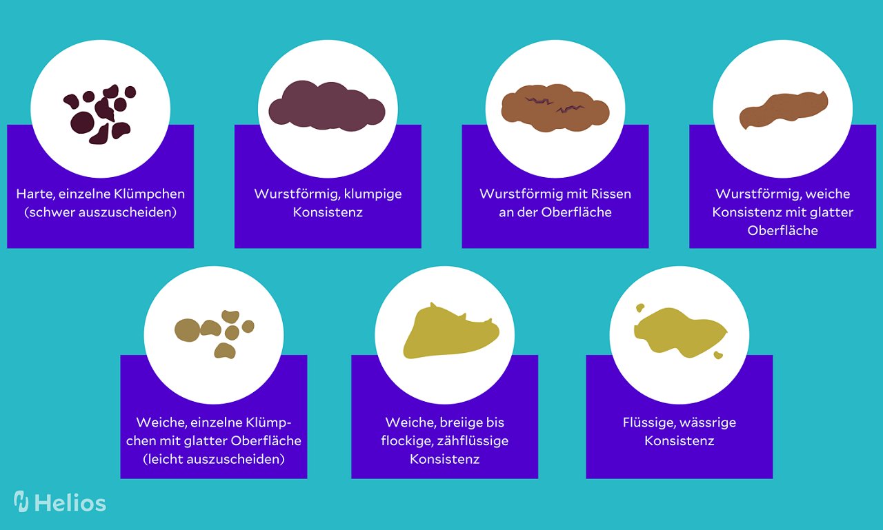 Stuhlformen Skala nach Bristol Infografik