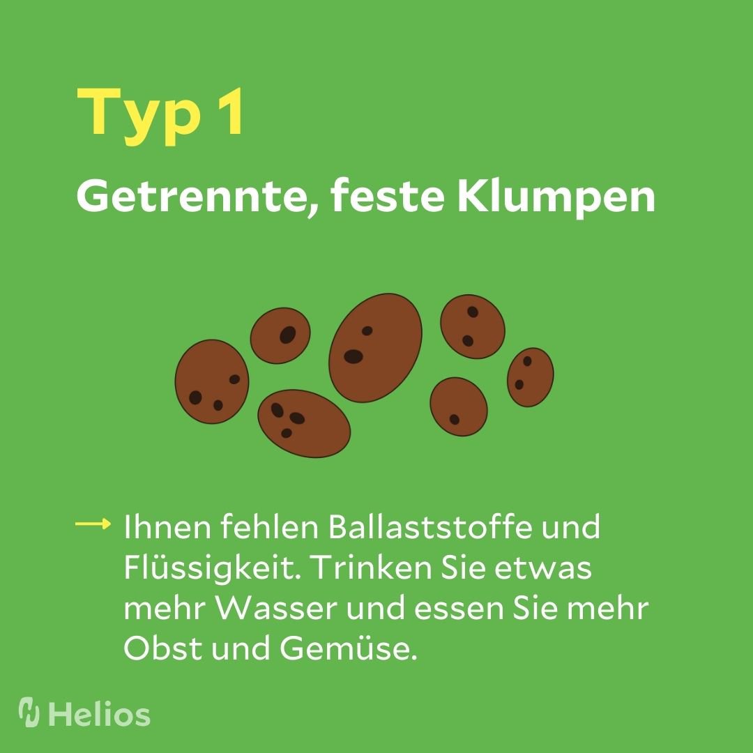 Stuhlgang getrennte, feste Klumpen