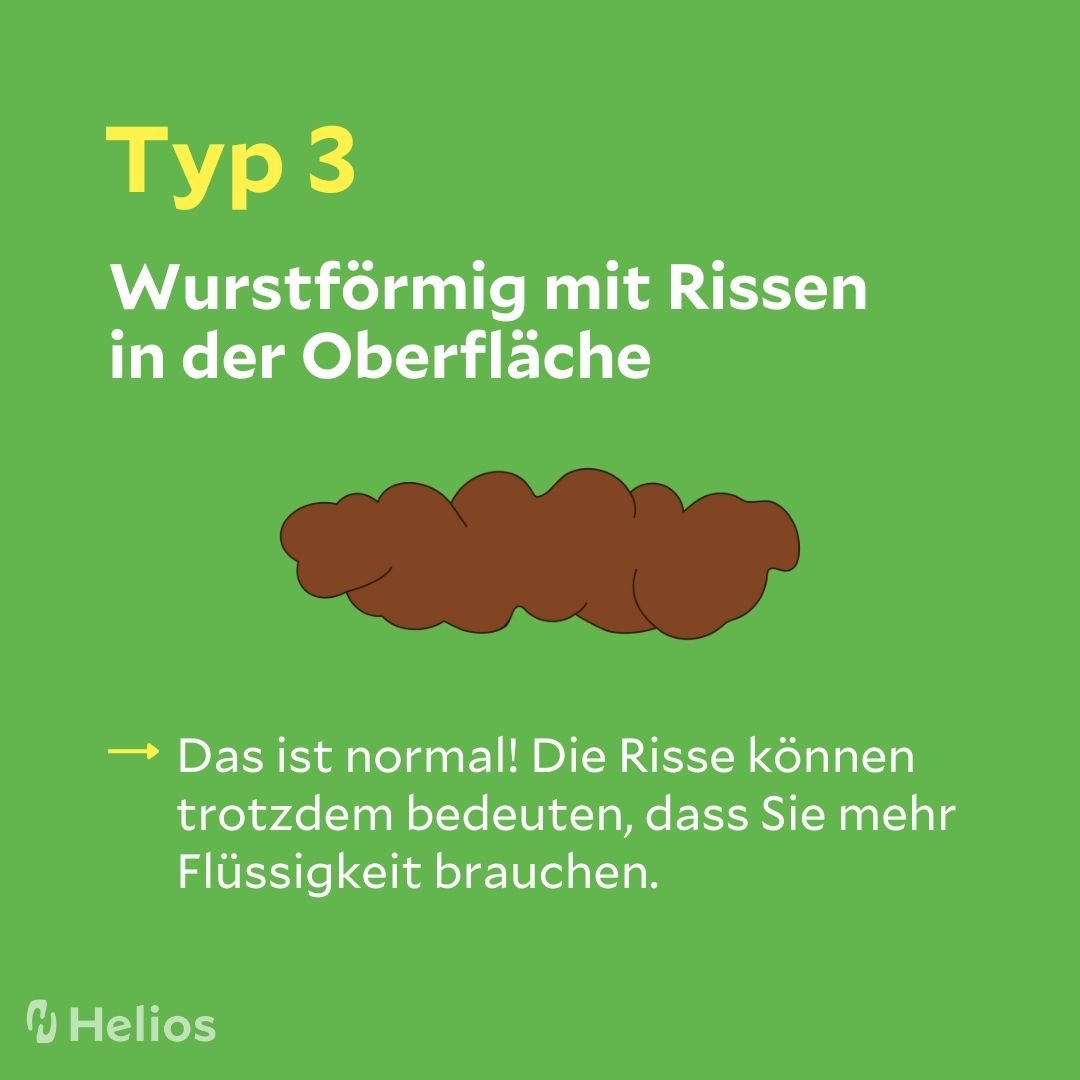 Stuhlgang wurstförmig mit Rissen