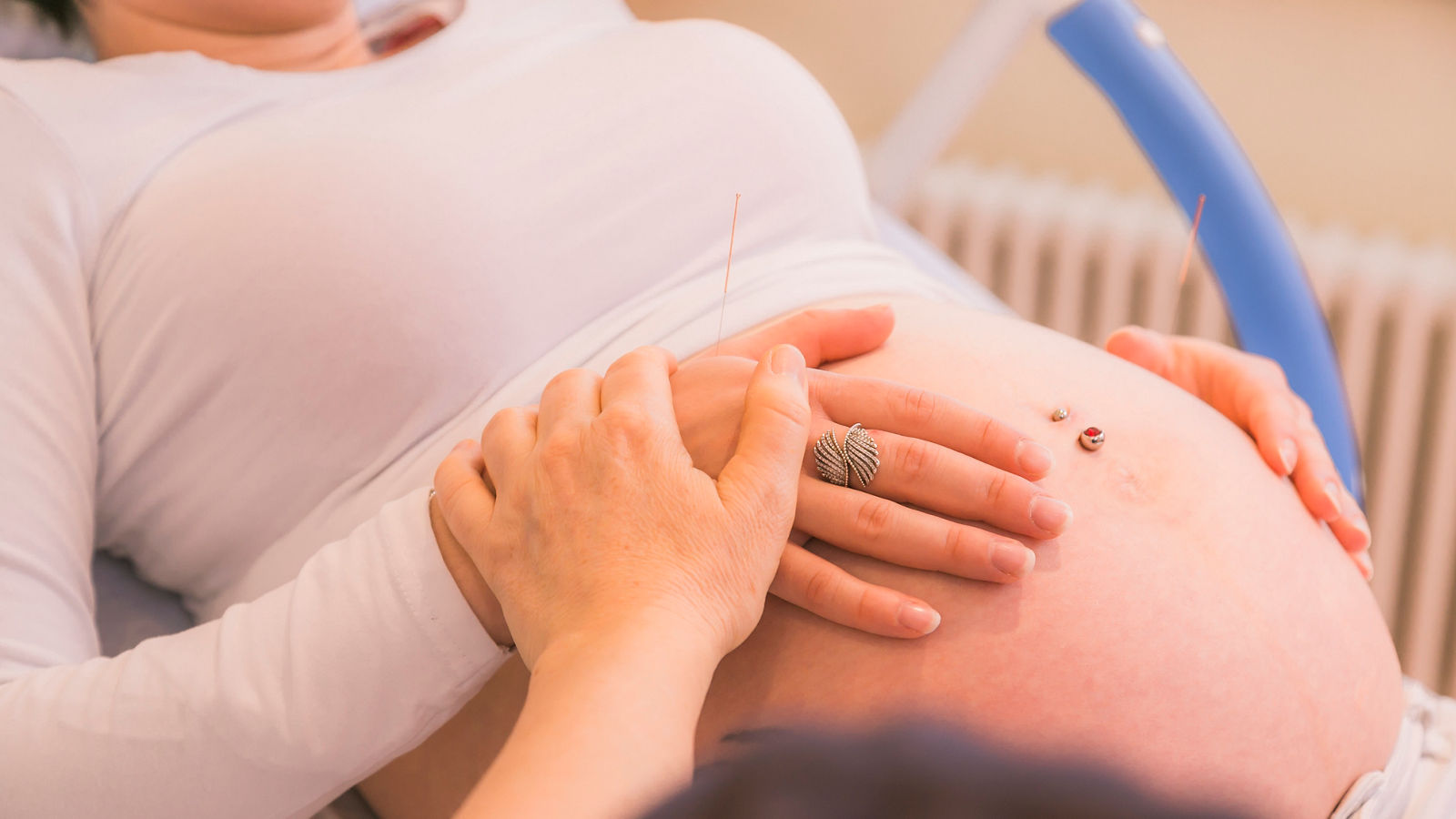 Akupunktur bei einer schwangeren Patientin