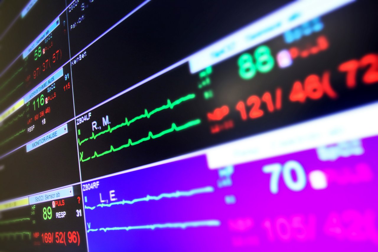 Vitalwerte - Monitor