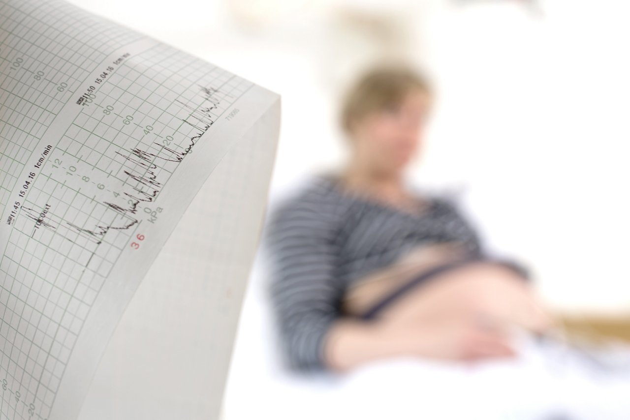 CT-Ausdruck, im Hintergrund eine Schwangere