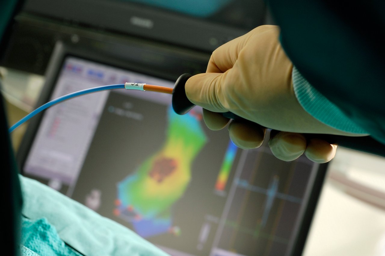 Linksherzkatheter-Ablation: Hand hält Katheter