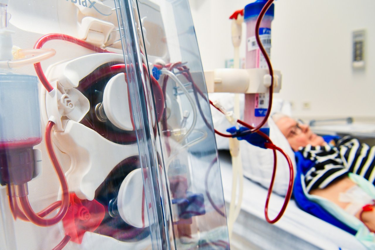 Helios Universitätsklinikum Wuppertal: Klinik für Nieren- und Hochdruckkrankheiten, 1.2024