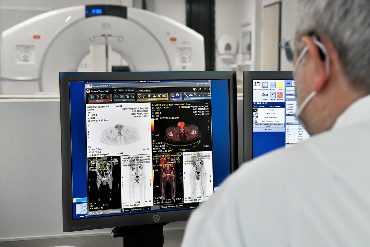 Nuklearmedizin - Blick auf den Monitor am PET-CT