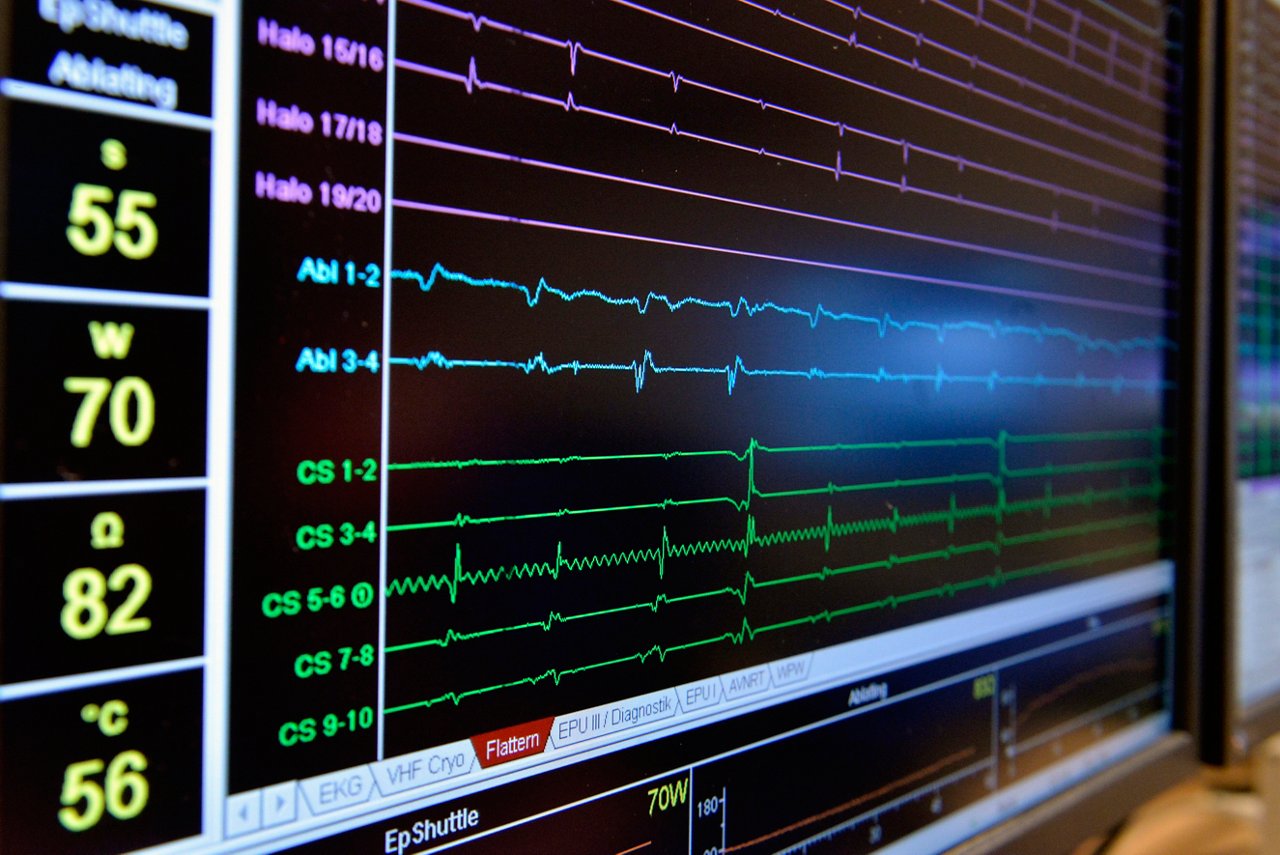 HELIOS Klinikum Siegburg: Kardiologie, 17.03.2016