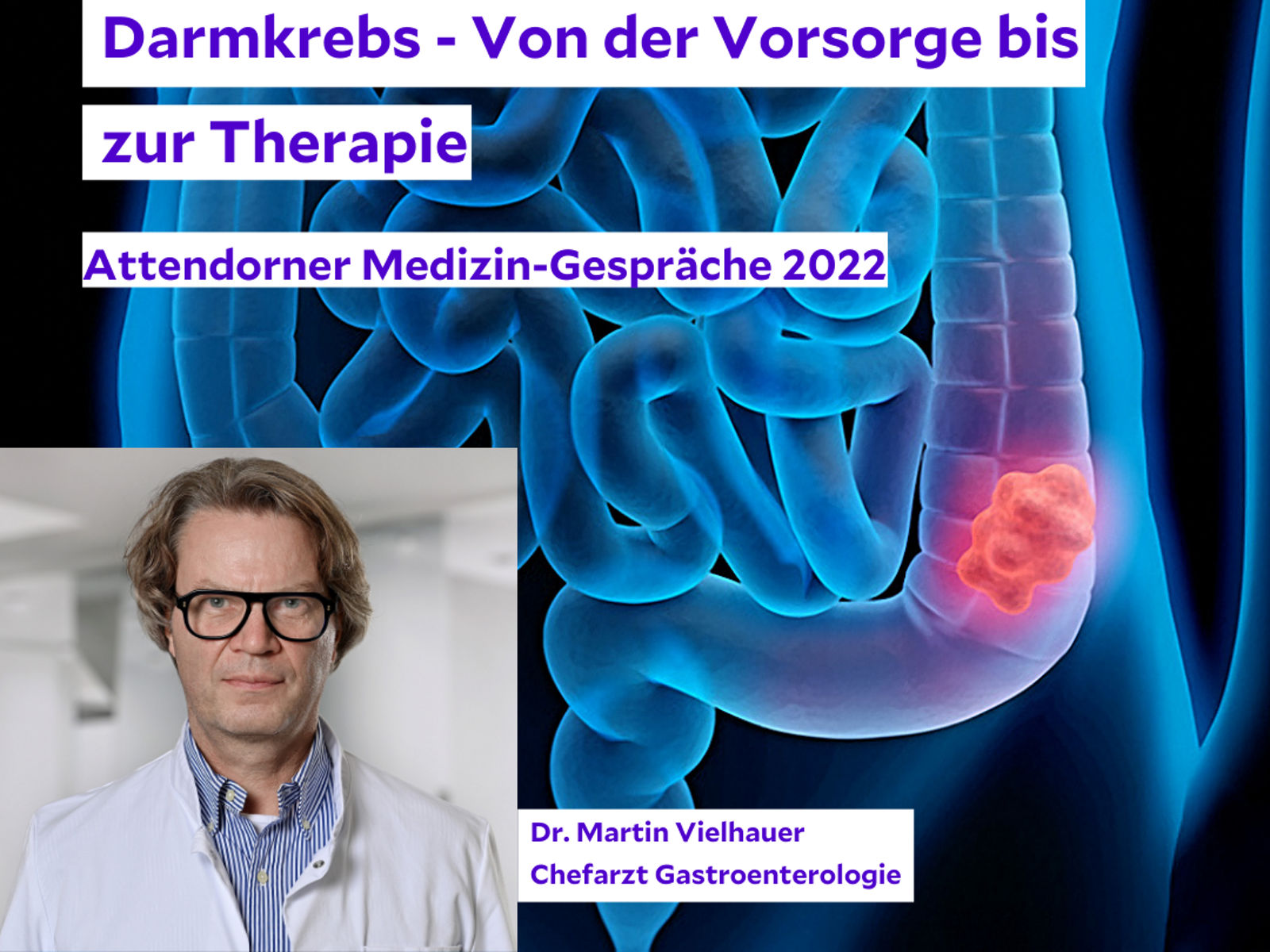 Attendorner Medizin-Gespräche 2022: Vortrag zum Thema Endoprothetik – zwischen Gestern, Heute und Morgen