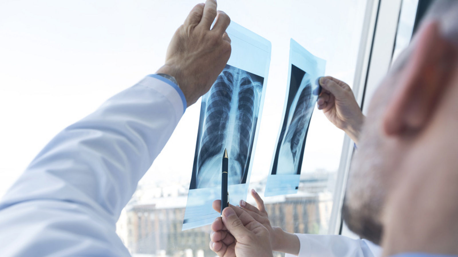 Group of doctors discuss x-ray