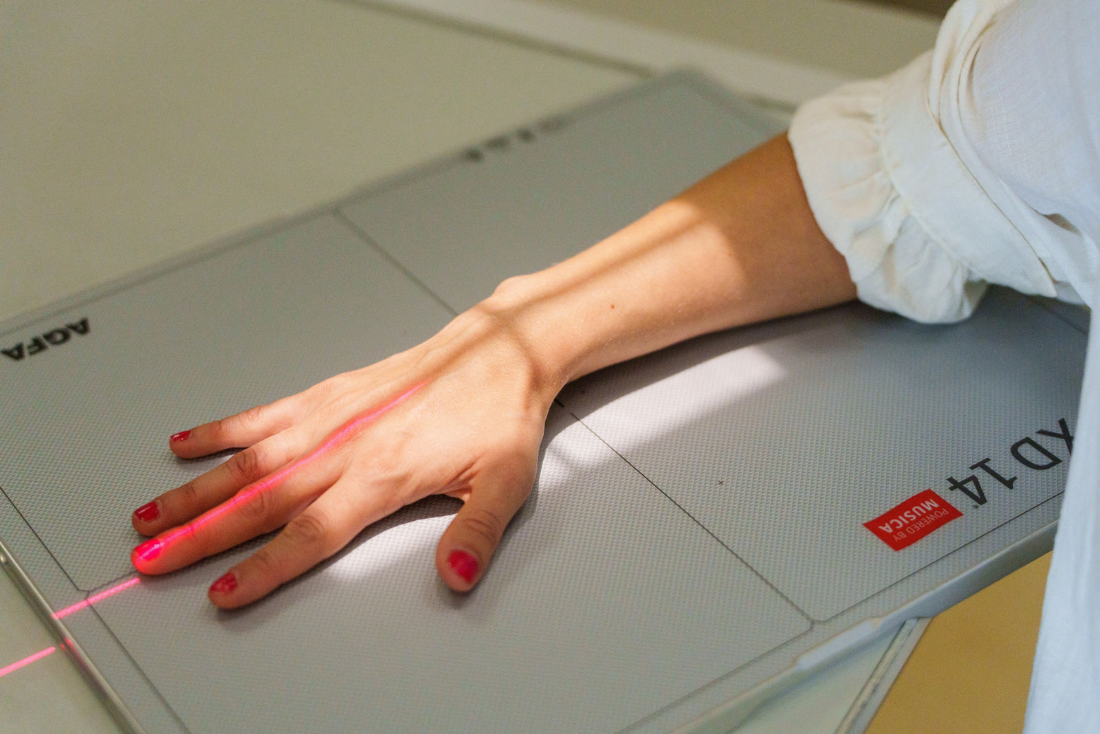 Wenn der Sturz auf die Hand zum Fall für Spezialisten wird