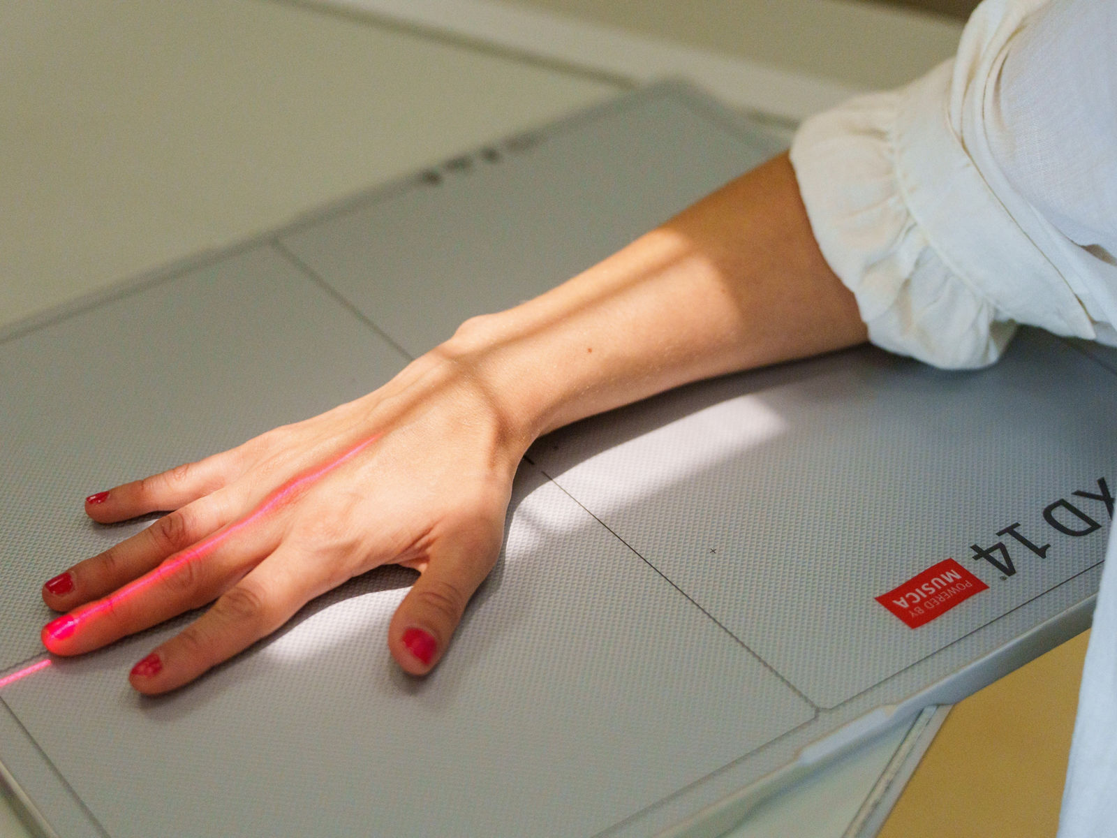 Wenn der Sturz auf die Hand zum Fall für Spezialisten wird