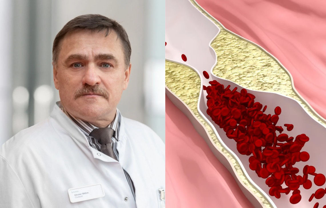 Vortrag zur Schaufensterkrankheit am 10.02.2026: Schmerzen beim Gehen und was dahintersteckt