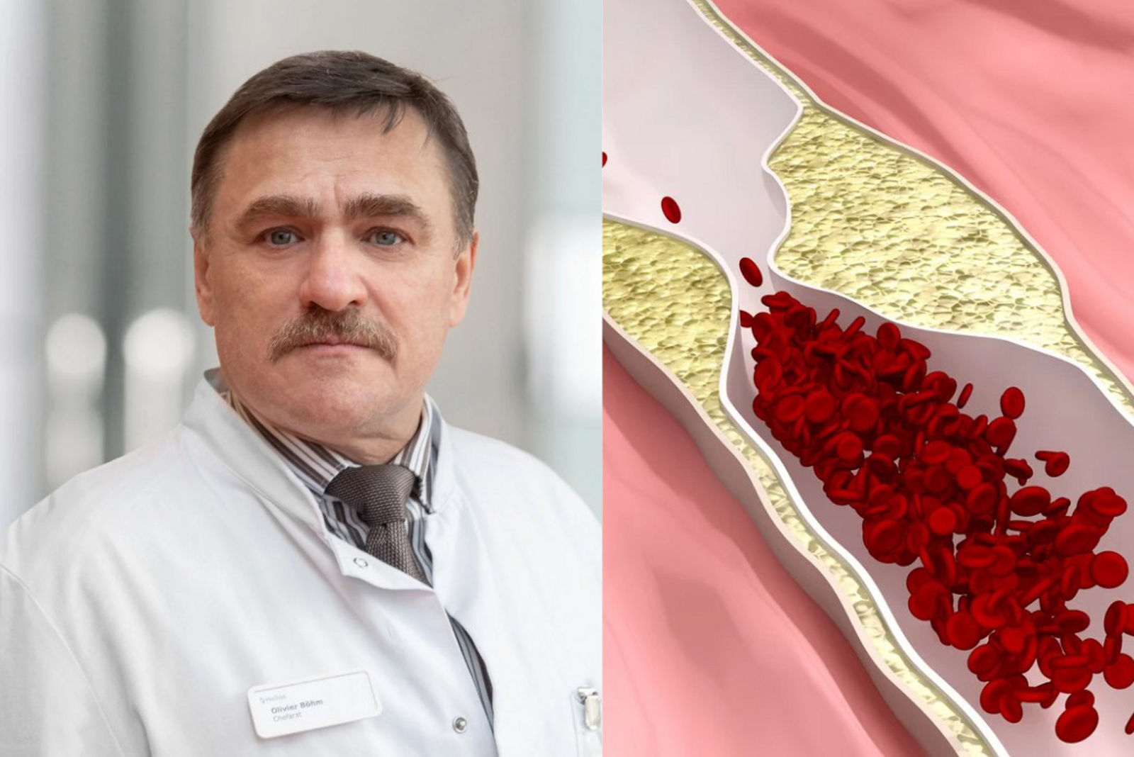 Vortrag zur Schaufensterkrankheit am 10.02.2026: Schmerzen beim Gehen und was dahintersteckt