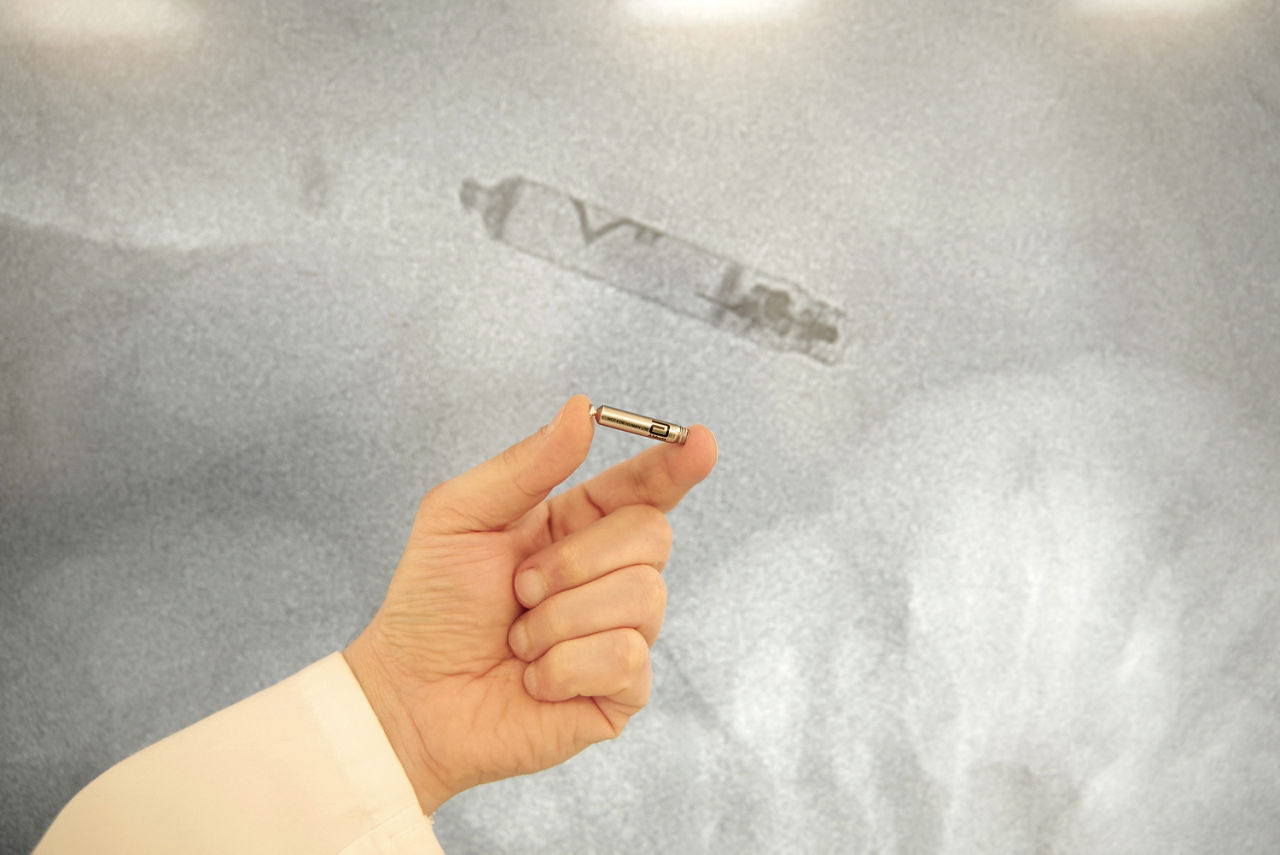 Erstmals kabelloser Herzschrittmacher an der Helios Frankenwaldklinik Kronach implantiert