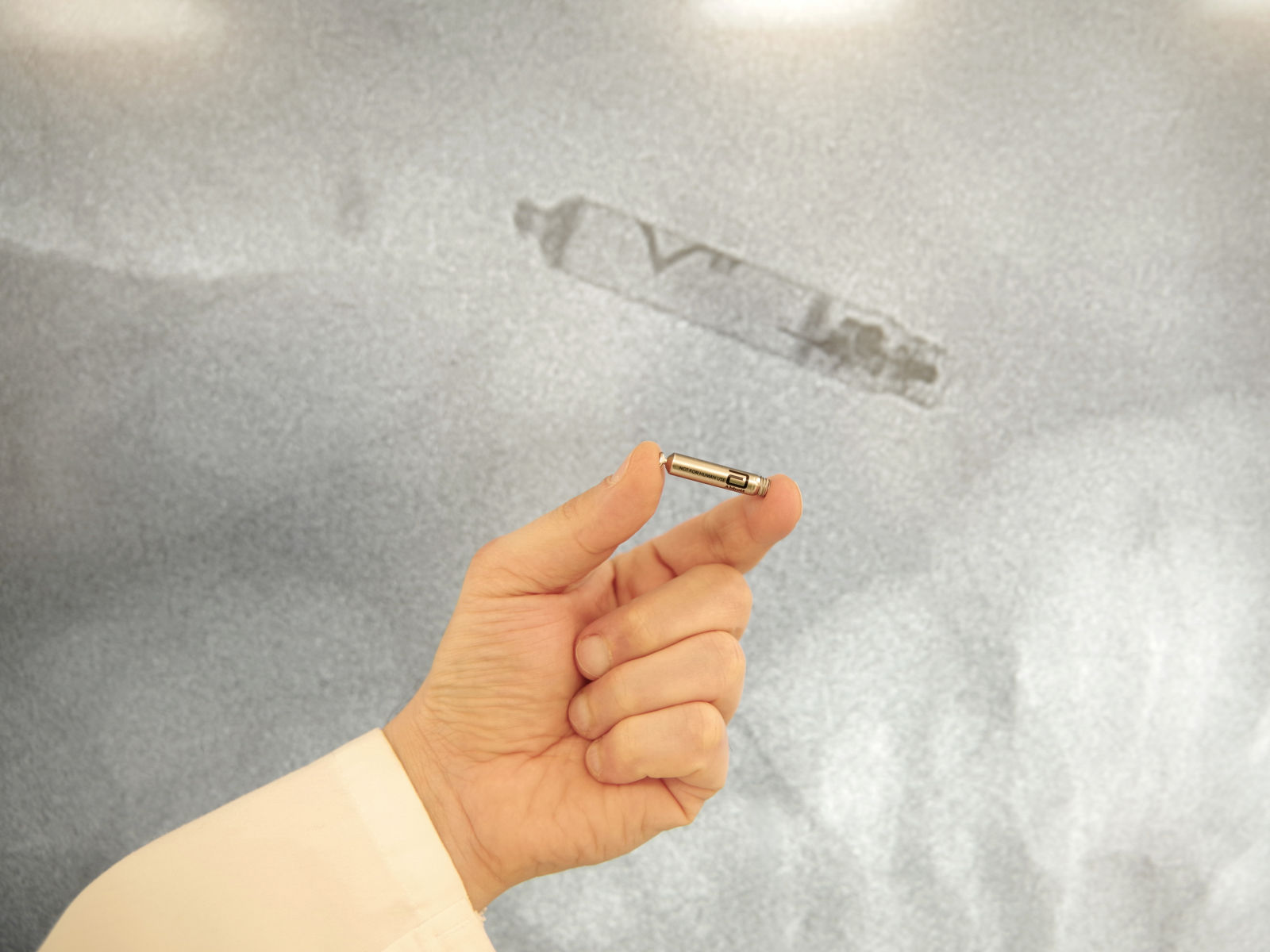 Erstmals kabelloser Herzschrittmacher an der Helios Frankenwaldklinik Kronach implantiert