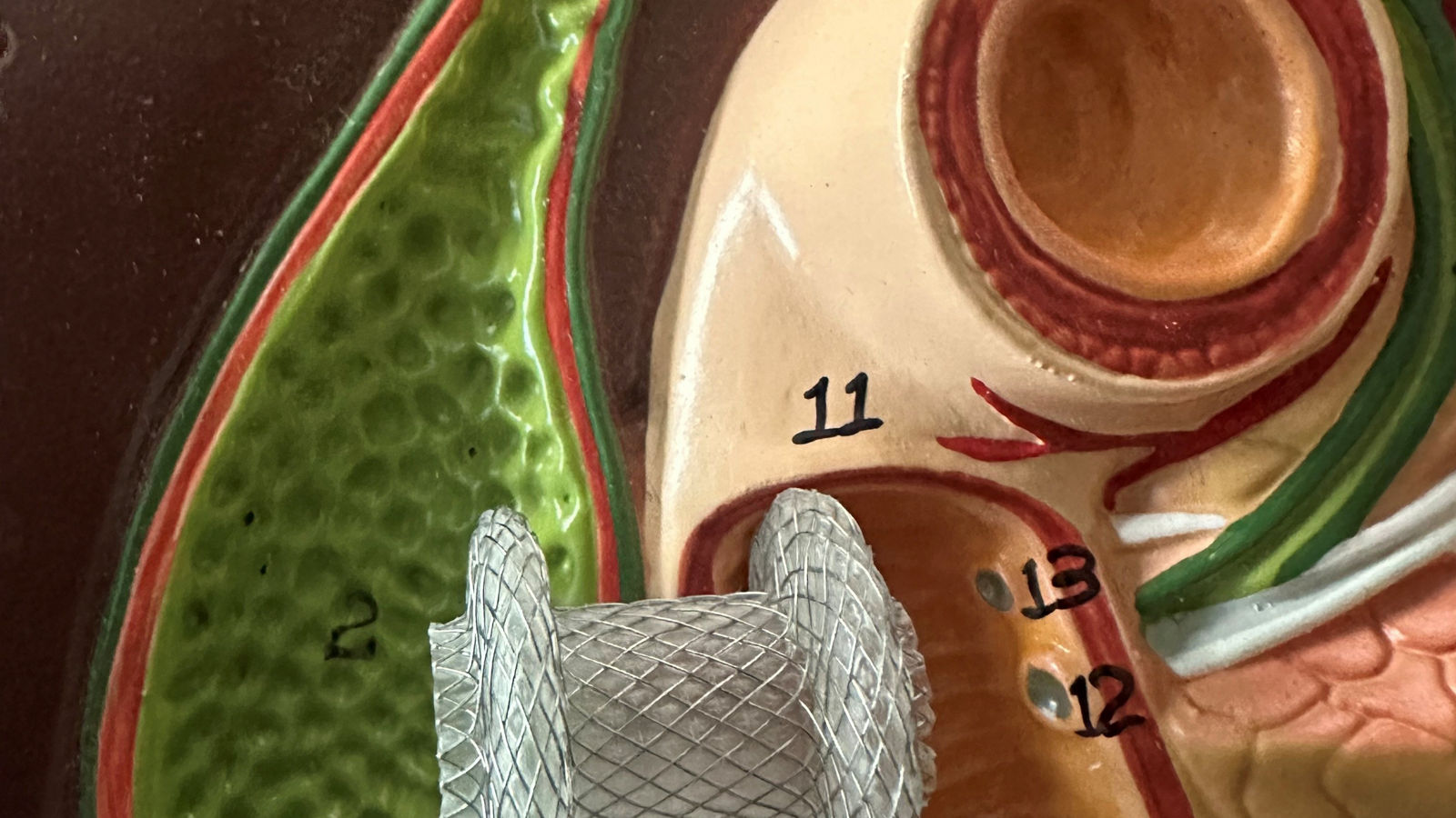 Axios-Stent Gallenblase Modell
