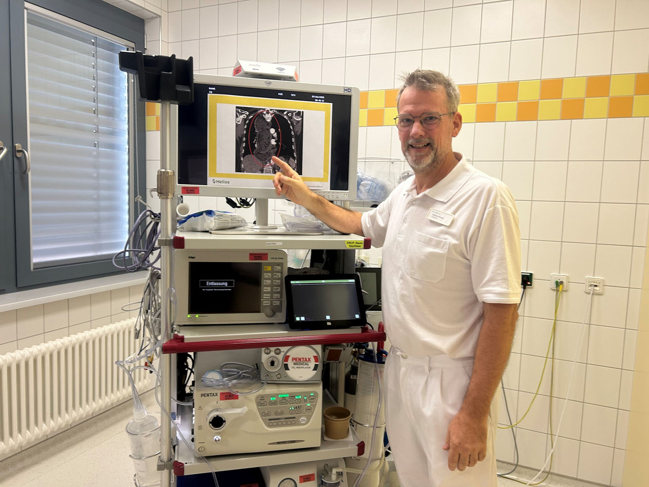 Seltene Diagnose nach jahrelangen Beschwerden: Speiseröhrenbehandlung bringt Lebensqualität zurück 