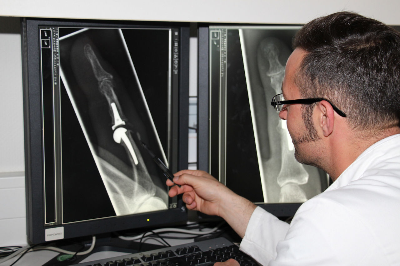 Wenn Hände und Finger höllisch schmerzen – ein Live-Talk rund um die Behandlung von Arthrose