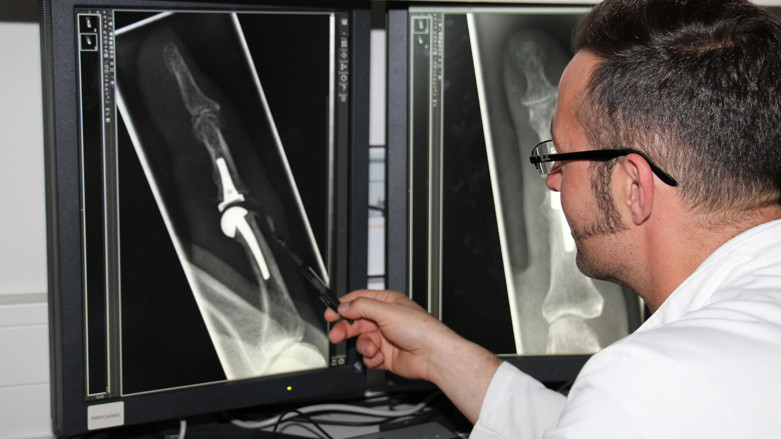 Wenn Hände und Finger höllisch schmerzen – ein Live-Talk rund um die Behandlung von Arthrose